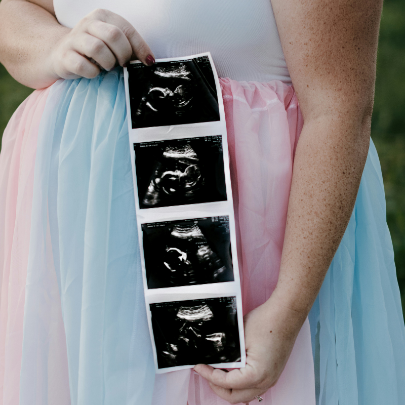 Miracle ultrasound and Spa images