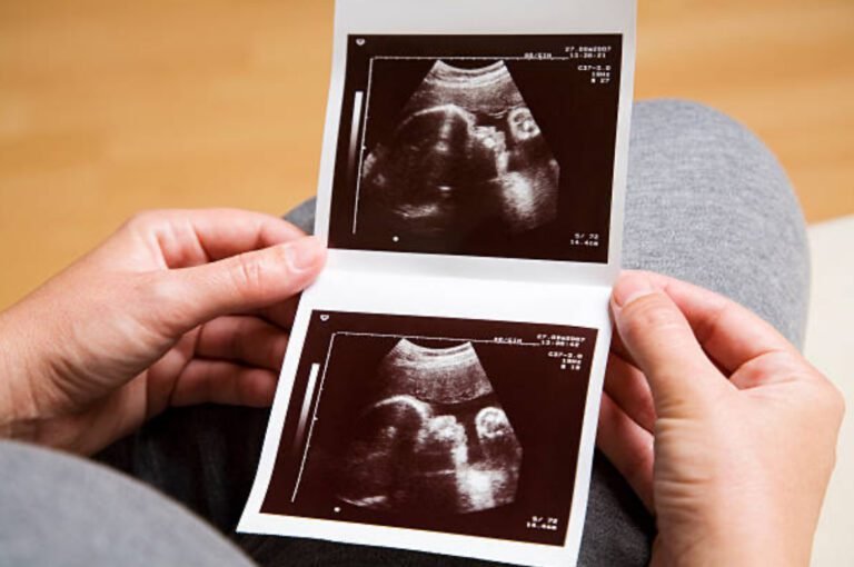 Ultrasound Fairfax VA