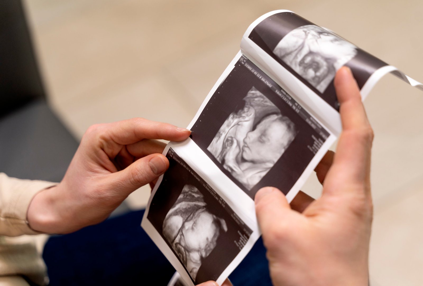 Ultrasound Haymarket VA