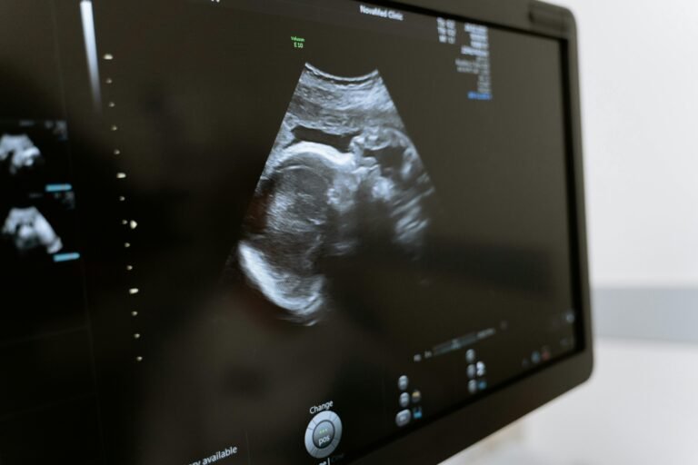 Ultrasound screen