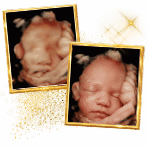 baby-ultrasound-3D-4D-image