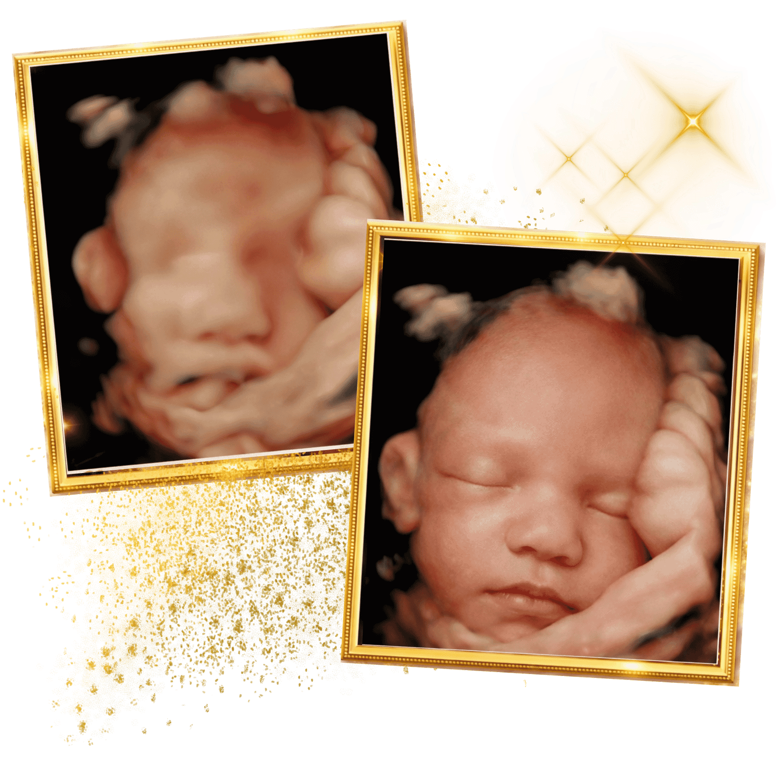 baby-ultrasound-3D-4D-image