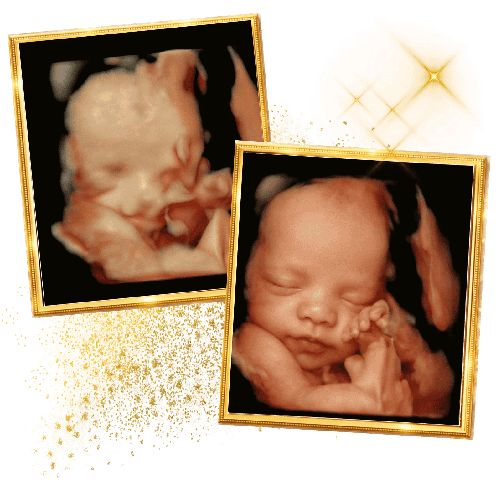 What Makes a Great 4D Ultrasound Video? Movements Families Love to Capture 2 3