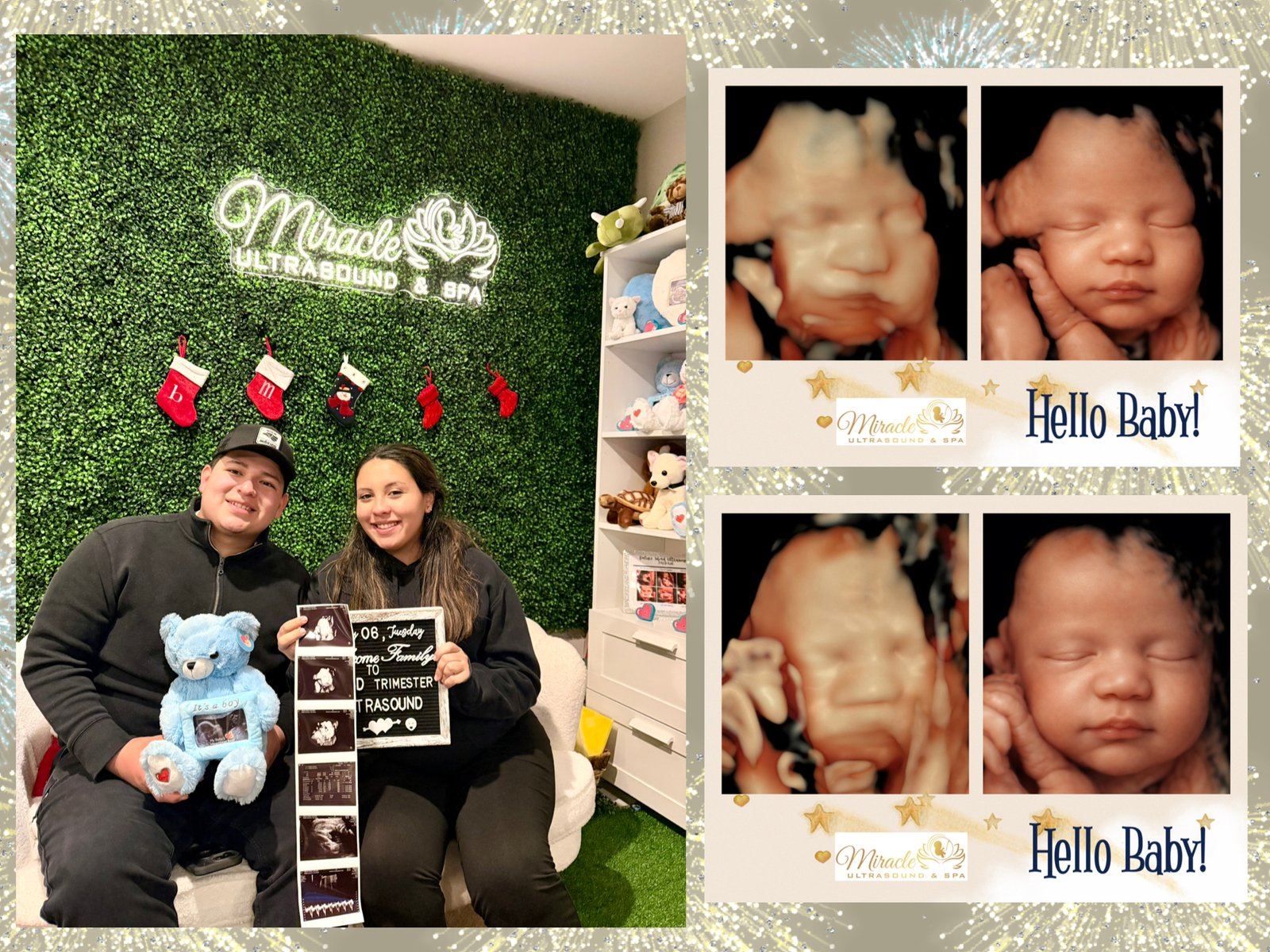miracle-ultrasound-and-spa-baby-ultrasound-before-and-after-16