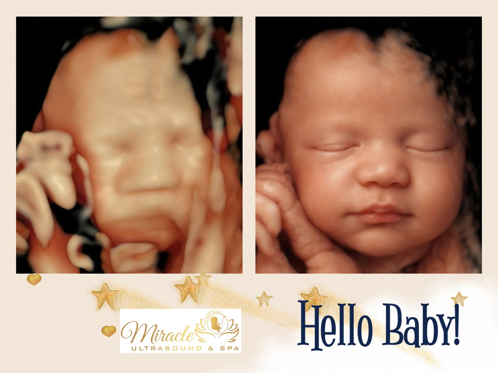miracle-ultrasound-and-spa-baby-ultrasound-before-and-after-17