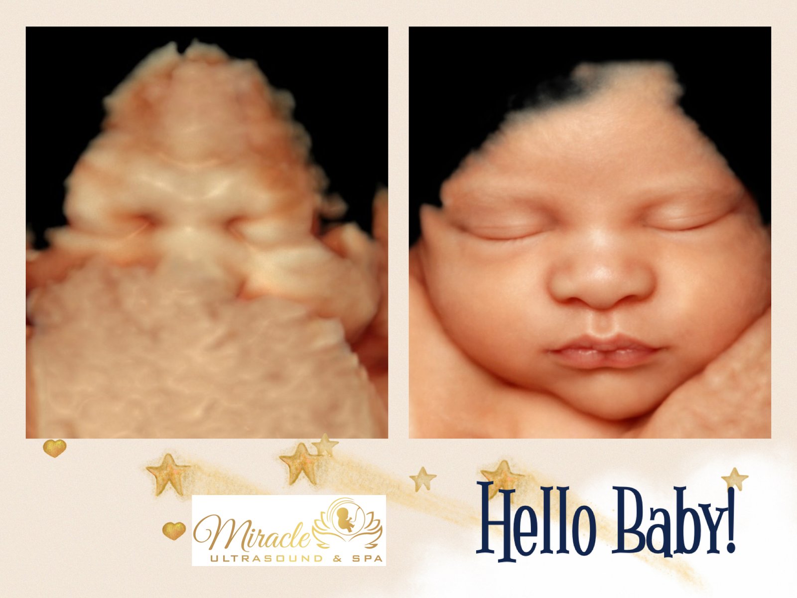 miracle-ultrasound-and-spa-baby-ultrasound-before-and-after-18