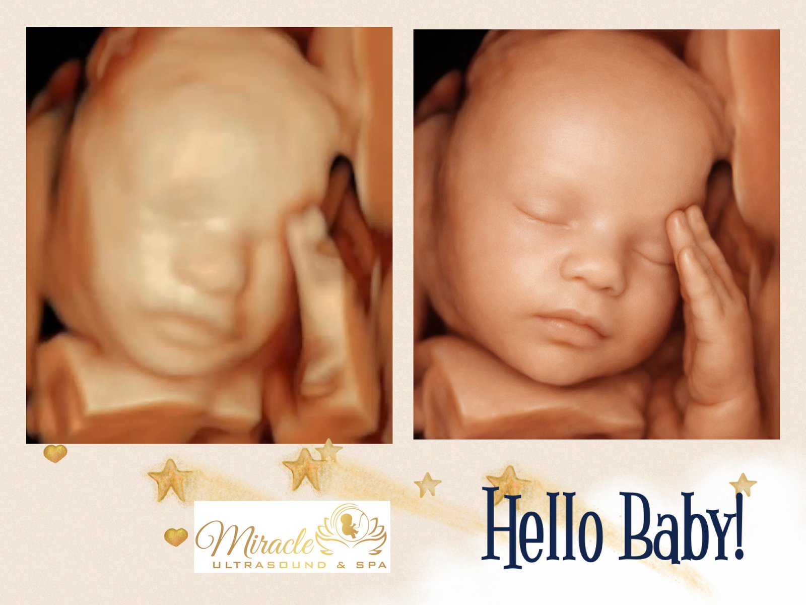 baby-ultrasound-4d-image-3d