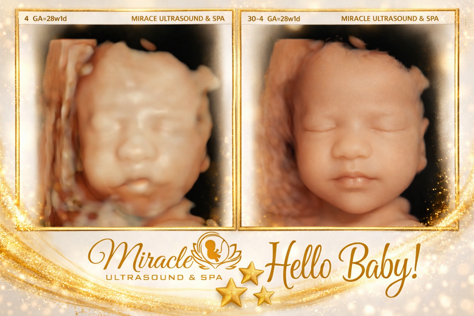miracle-ultrasound-and-spa-baby-ultrasound-before-and-after-3