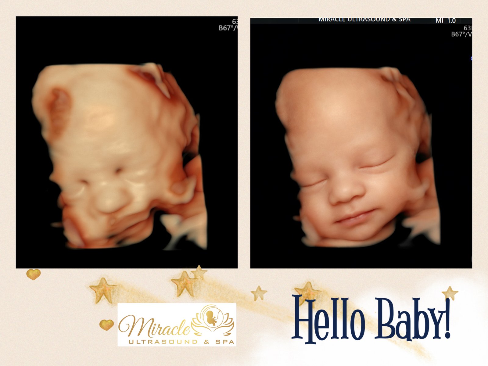 ultrasound-guide-family-va