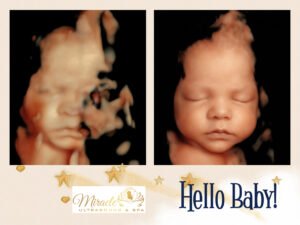 baby-ultrasound-3d-imaging-miracle