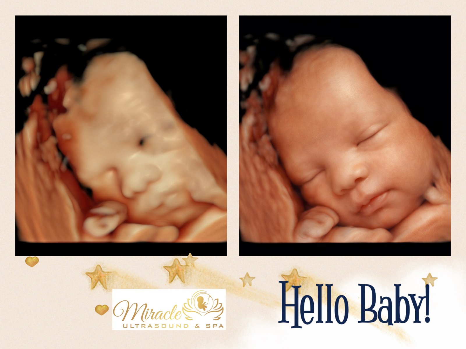 miracle-ultrasound-and-spa-baby-ultrasound-before-and-after-35