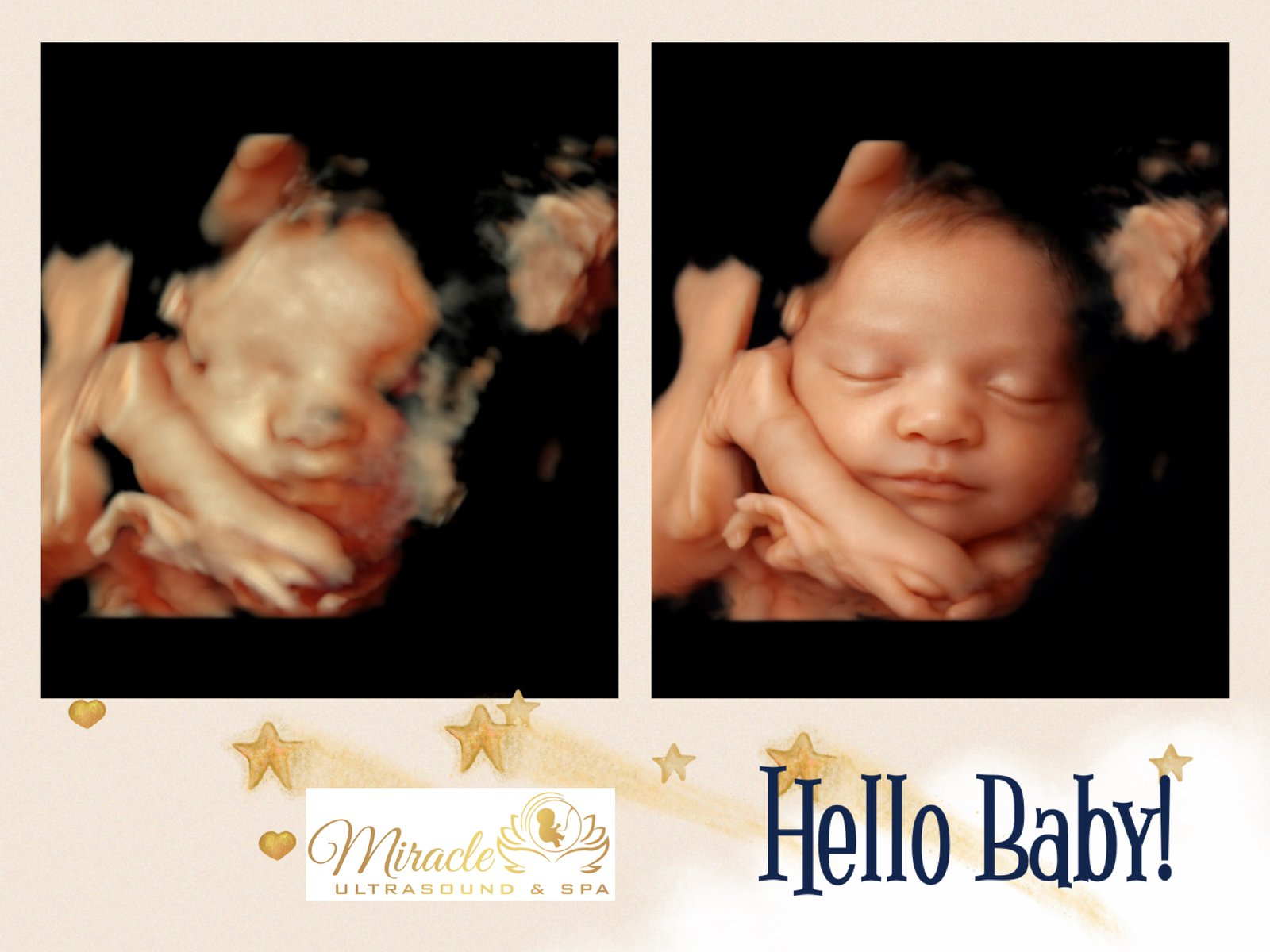 miracle-ultrasound-and-spa-baby-ultrasound-before-and-after-36