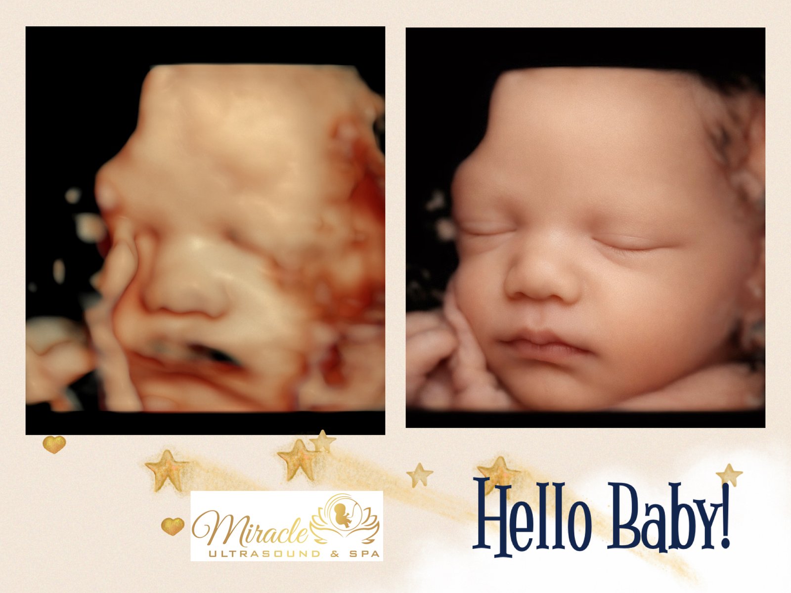 miracle-ultrasound-and-spa-baby-ultrasound-before-and-after-37