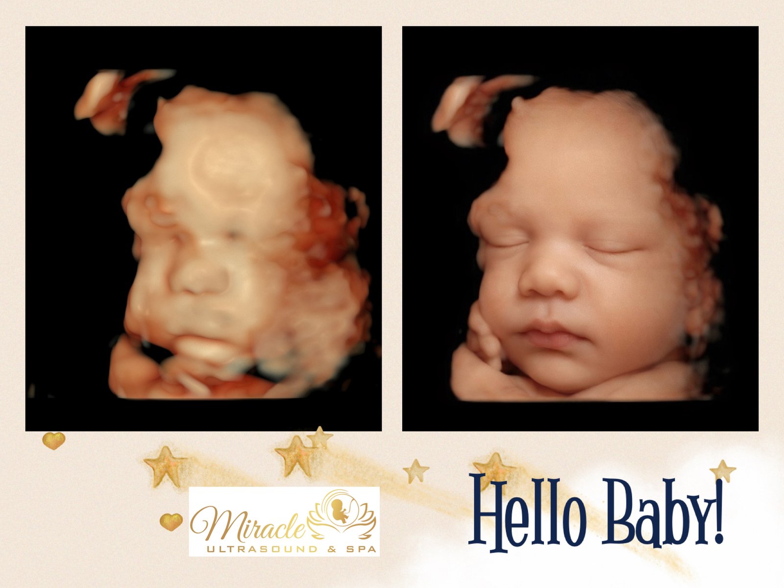 miracle-ultrasound-and-spa-baby-ultrasound-before-and-after-38