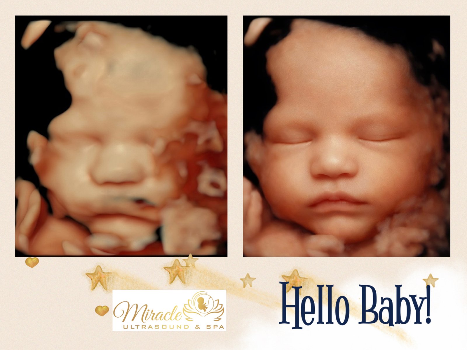 miracle-ultrasound-and-spa-baby-ultrasound-before-and-after-39