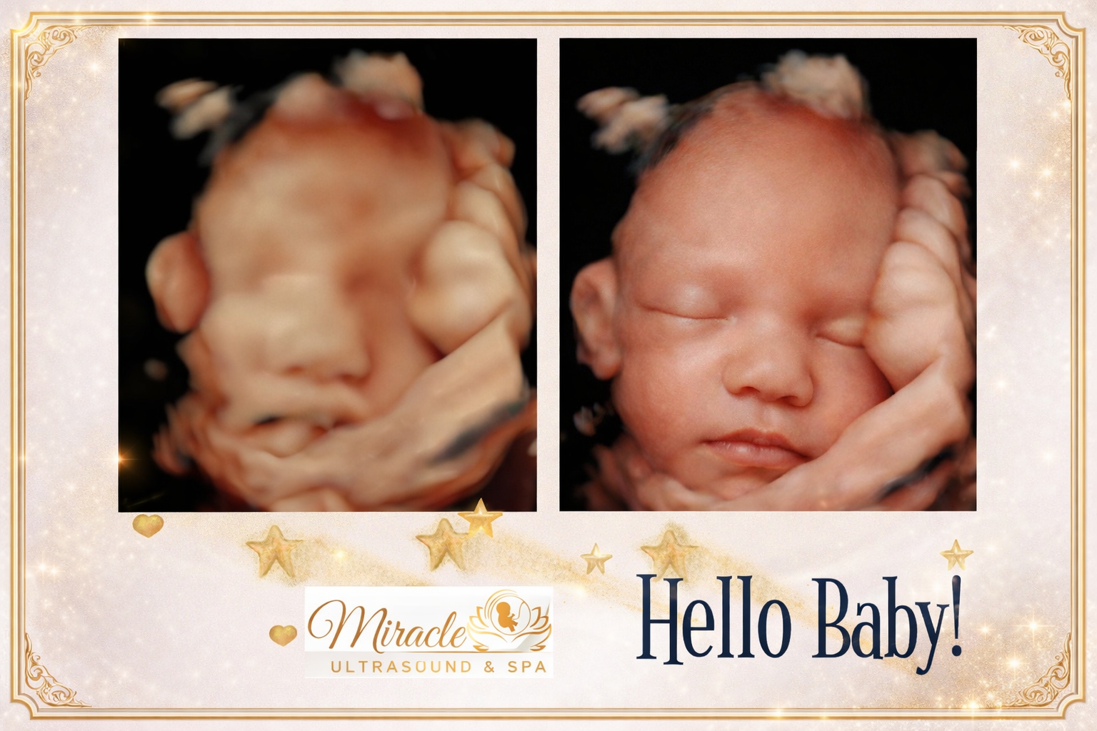 1 Pregnancy, 2 Special Visits: When to Book Your First and Final Keepsake Ultrasounds 2 miracle ultrasound and spa baby ultrasound before and after 47