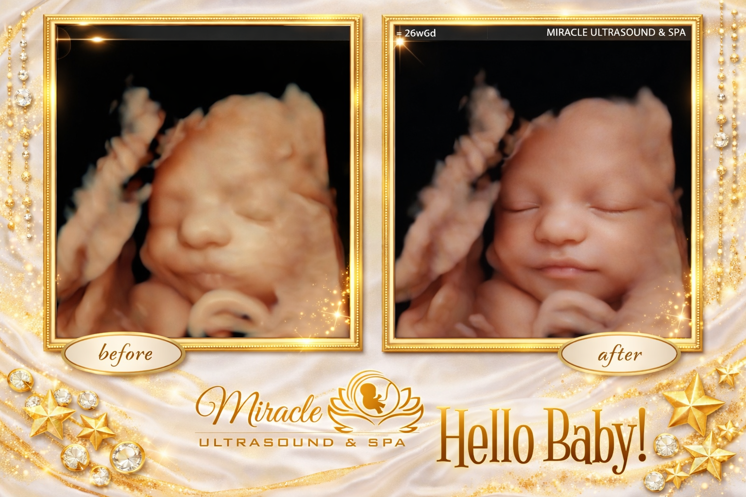 miracle-ultrasound-and-spa-baby-ultrasound-before-and-after-49