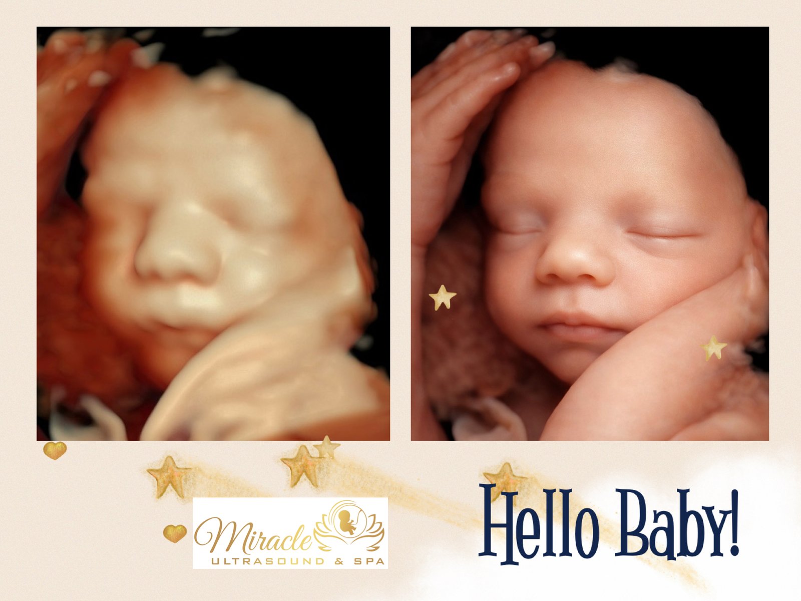 miracle-ultrasound-and-spa-baby-ultrasound-before-and-after-9