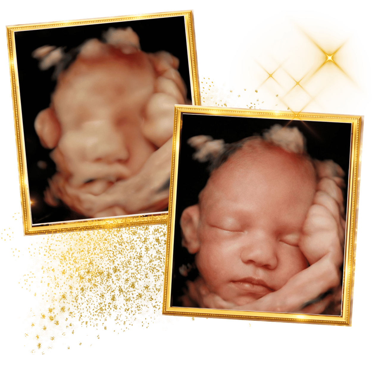Why Does Your Baby Cover Their Face During a 3D Ultrasound? 3 baby-images-ultrasound-relaxing