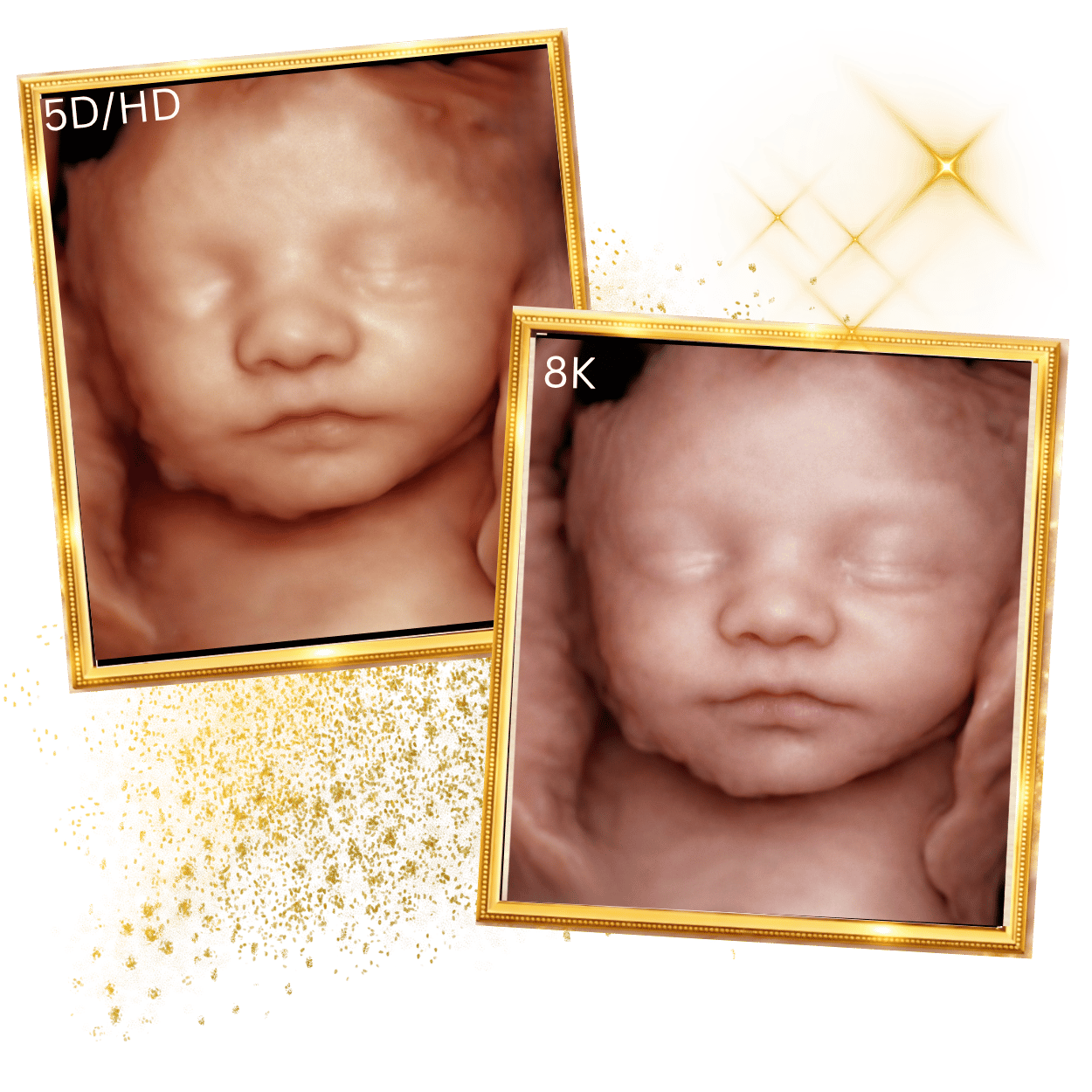 mriacle ultrasound and spa before and after baby pictures3