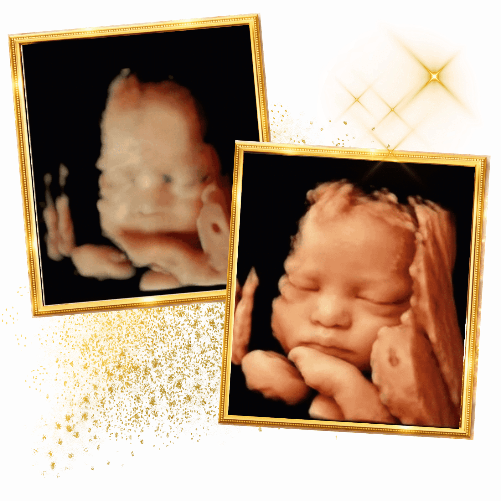 Home 6 miracle-ultrasound-spa-beforeand-after-baby-ultrasound-10