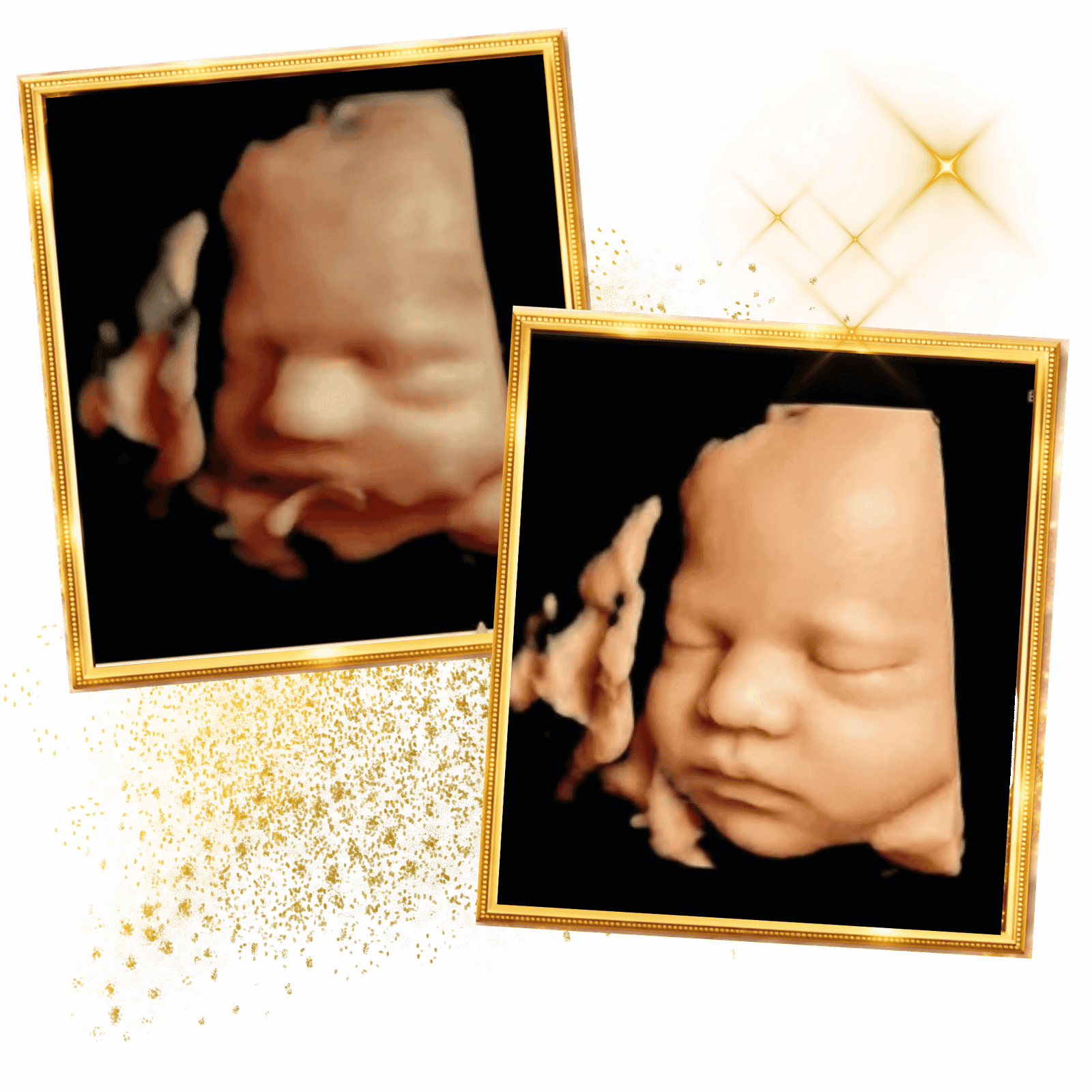 Home 5 miracle-ultrasound-spa-beforeand-after-baby-ultrasound9